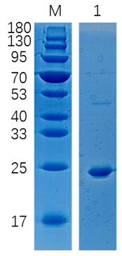 15% SDS-PAGE analysis profiles of purified PRNP (CBB stained).